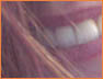 Smile1