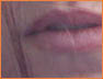 Smile4