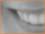 Smile5